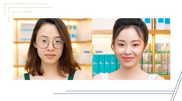 Phun môi ở đâu đẹp: Hình ảnh khách hàng của TMV Ngọc Dung